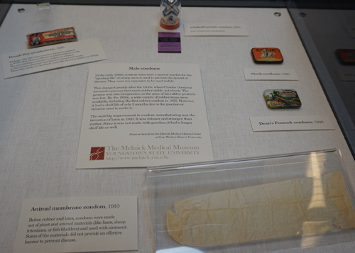 Youngstown State University is displaying a collection of contraceptives in a new exhibit at the Lin